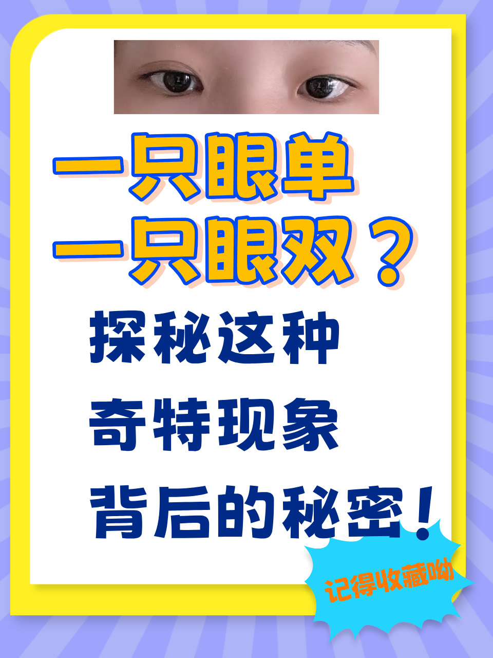 eac眼睛测谎(crimastereac眼睛测谎)