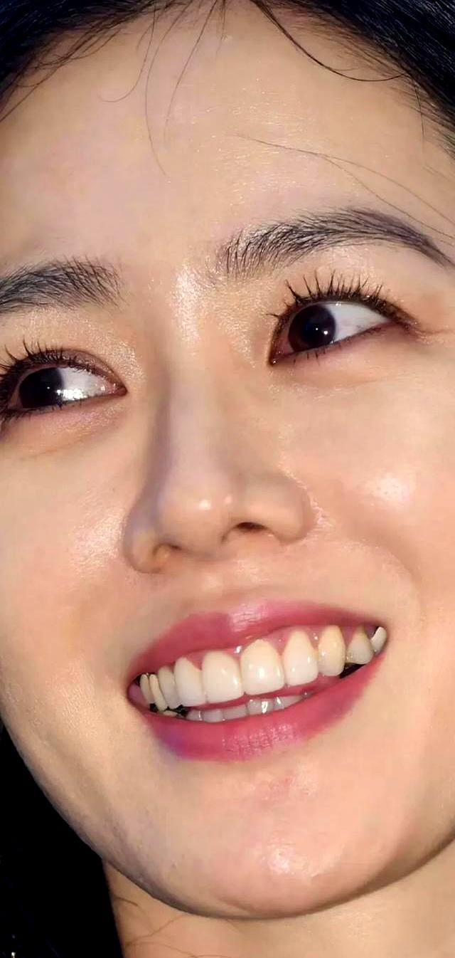 孙艺珍整容(孙艺珍整容折新氧)