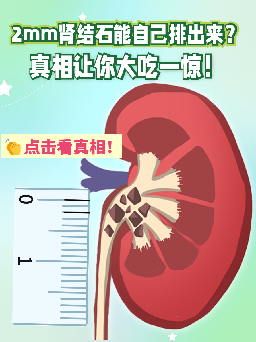 肾结石能喝酸奶吗(肾结石可不可以喝豆浆和牛奶)