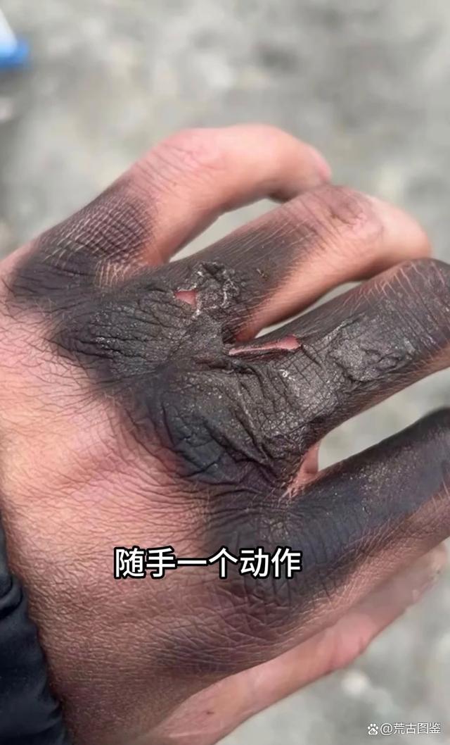 空手指头(莲蓬乳,空手指,芝麻手,牙膏脸)