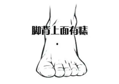 脚上有痣图解(脚上有痣图片大全)