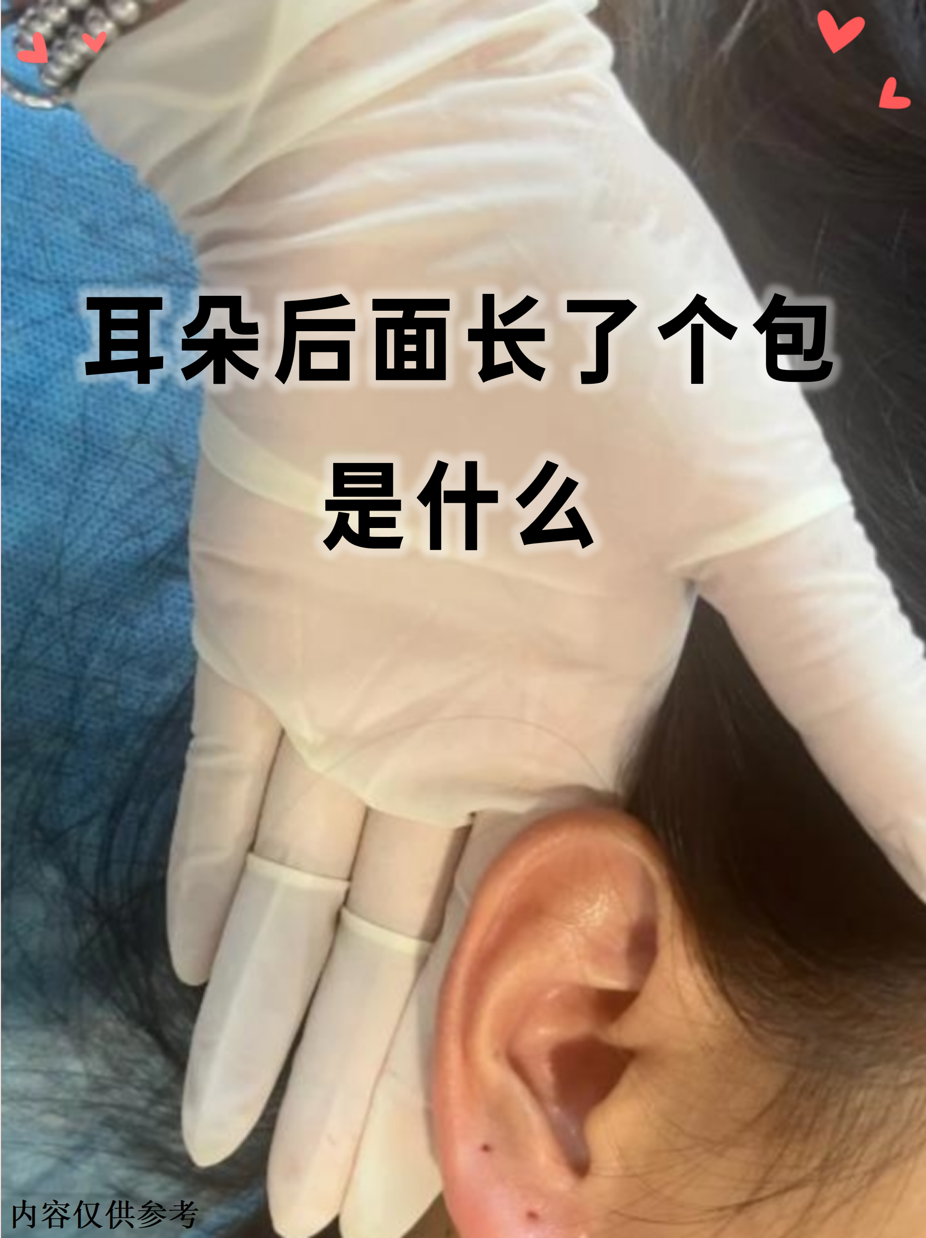 一个工一个耳朵旁(一个工字一个耳朵旁是什么字)