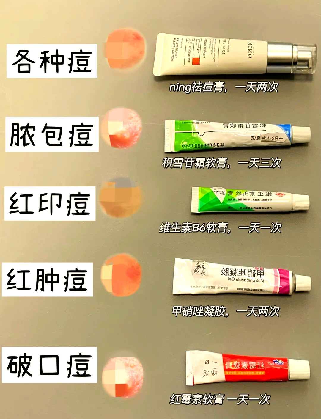 班赛适用于哪种痘痘(班赛可以去红肿痘痘吗)