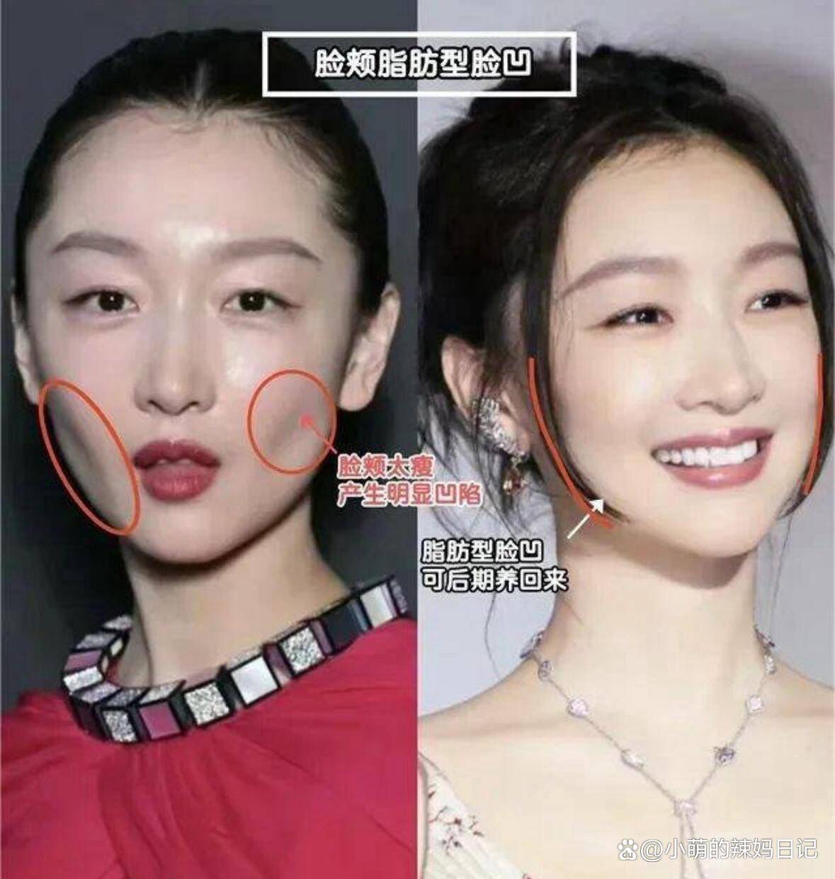尖酸刻薄的女人的面相(尖酸刻薄的女人的面相网络上怎么叫)