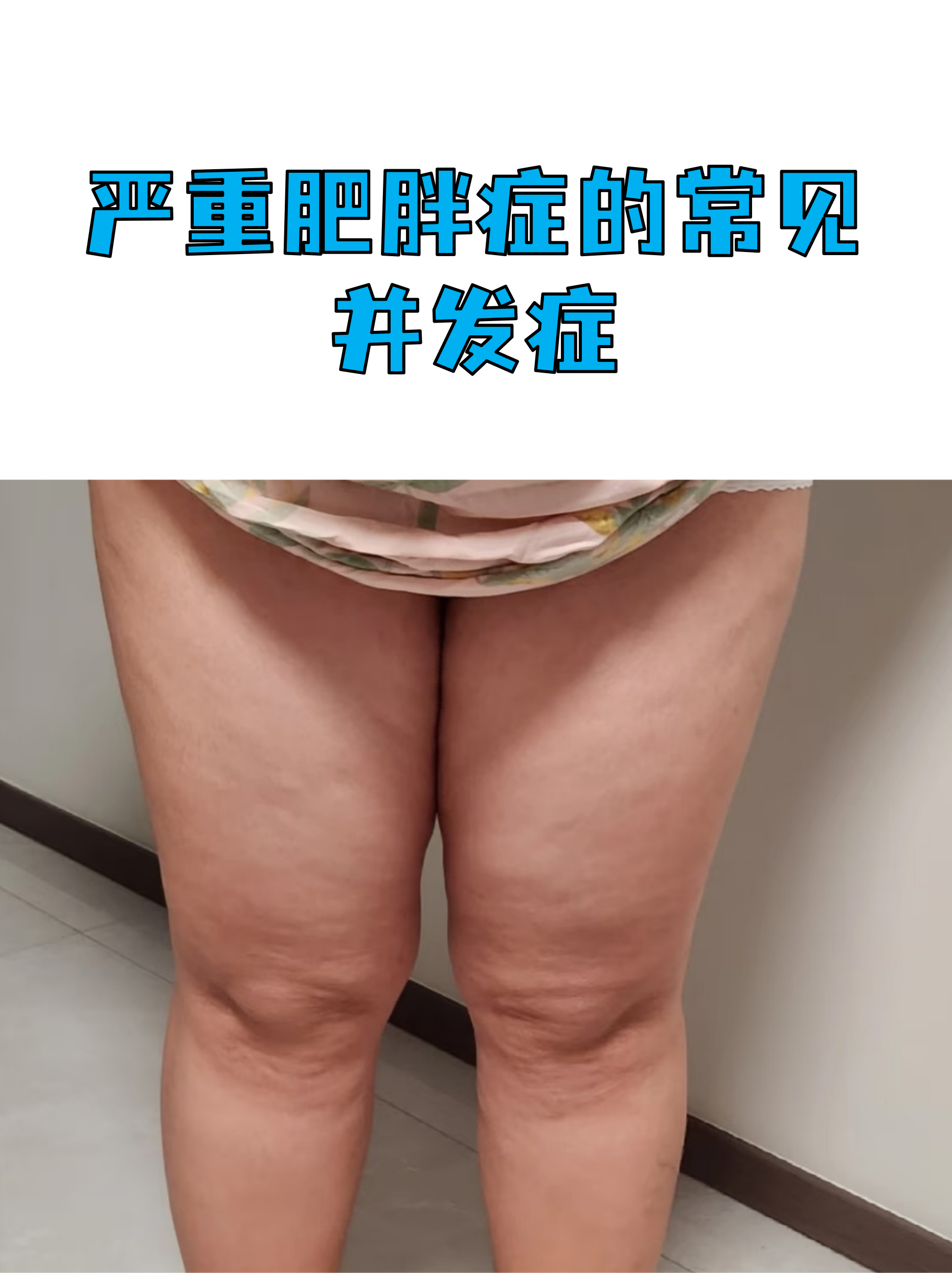 心宽体胖为什么念pan(心宽体胖的读音是什么意思)