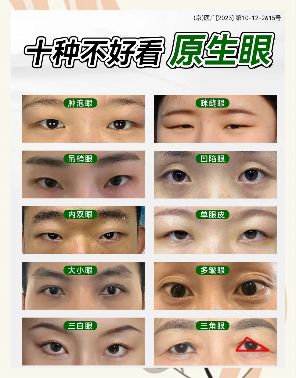 各种眼睛的形状和名称(各种眼睛的形状和名称英语翻译)
