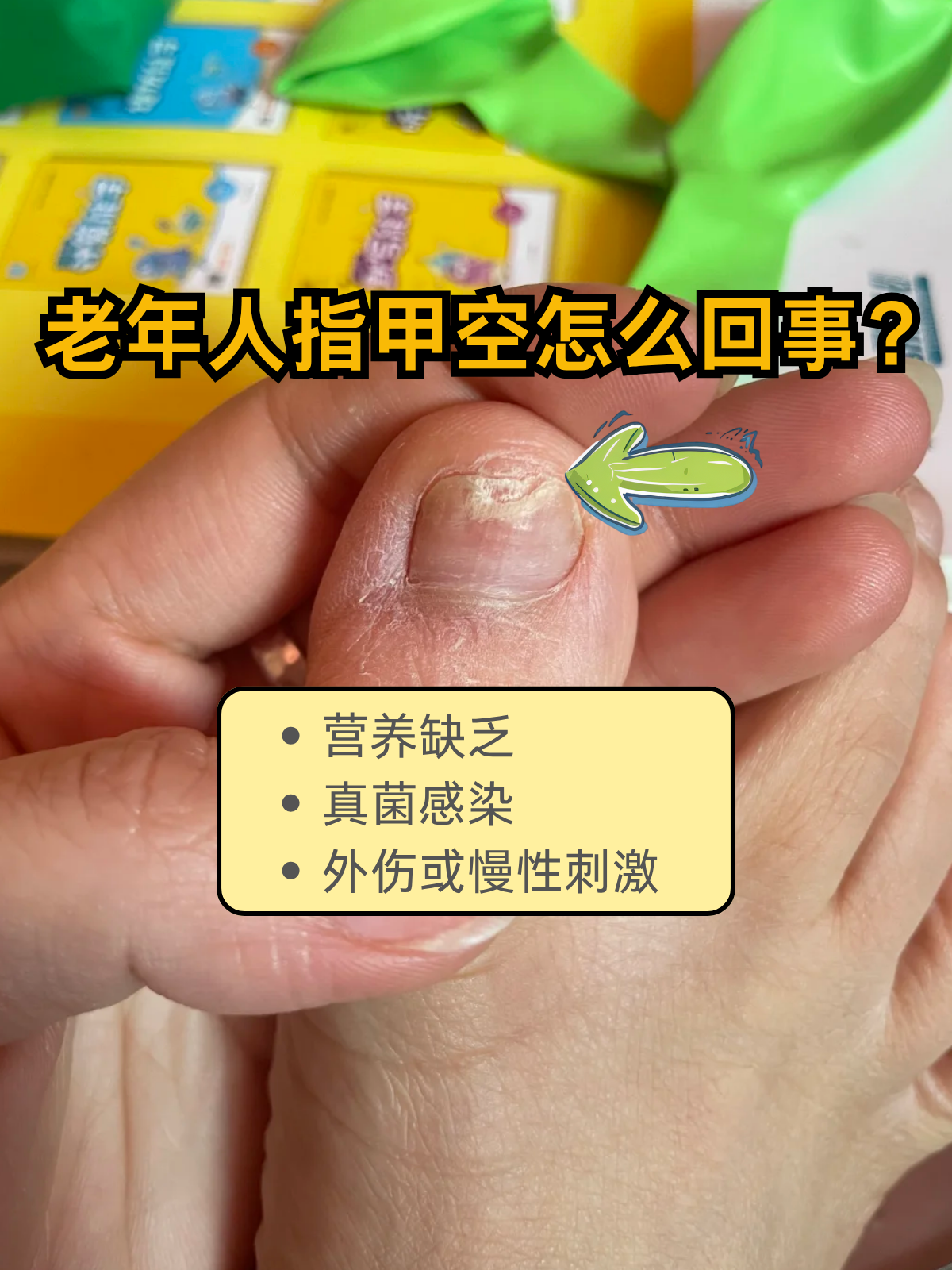 指甲变空了留还是剪掉(指甲变空了留还是剪掉空壳图片)