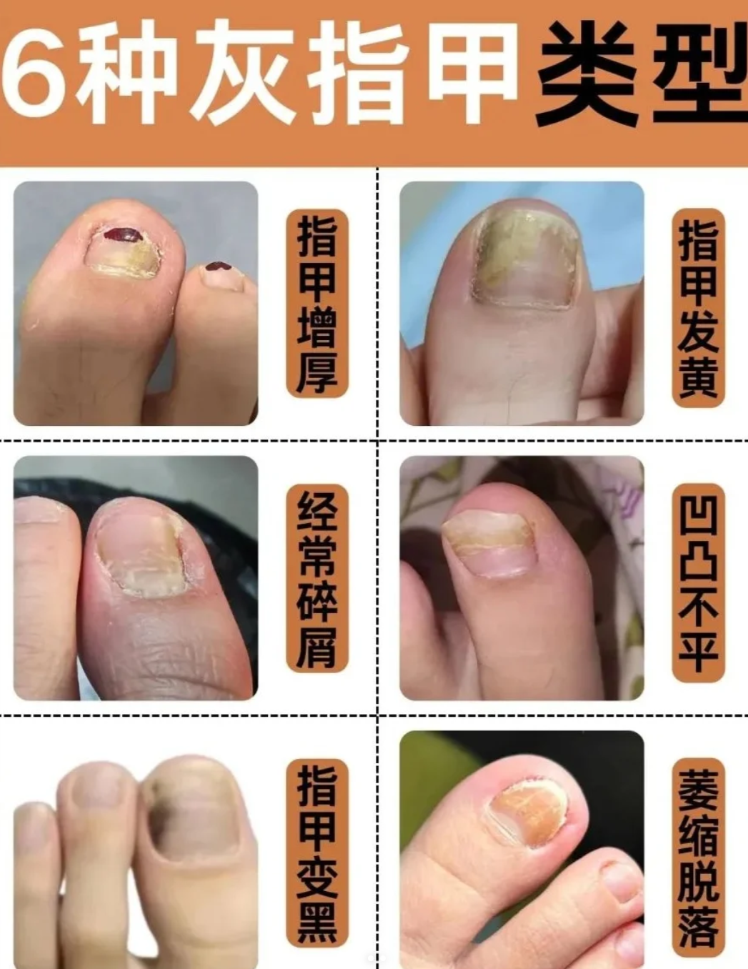 指甲变空了留还是剪掉(指甲变空了留还是剪掉空壳图片)