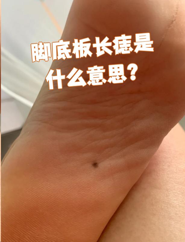 脚心有痣男人什么意思(脚心有痣男人什么意思啊)