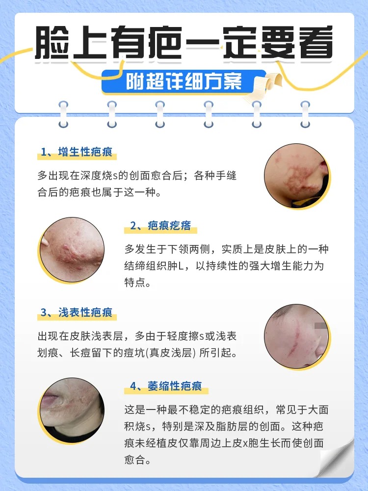 复方肝素钠尿囊素凝胶祛疤效果怎么样(复方肝素钠尿囊素凝胶去疤痕疙瘩效果好吗) 复方肝素钠尿囊素凝胶祛疤效果怎么样(复方肝素钠尿囊素凝胶去疤痕疙瘩效果好吗)