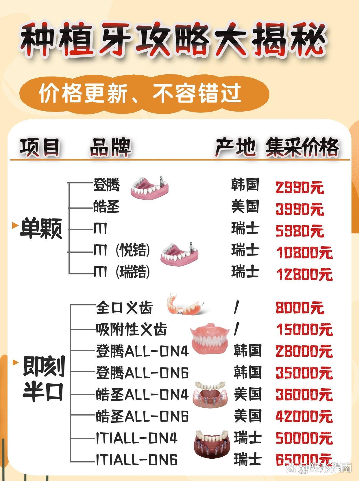 2022种植牙价目表(2021种植牙收费价目) 2022种植牙价目表(2021种植牙收费价目)