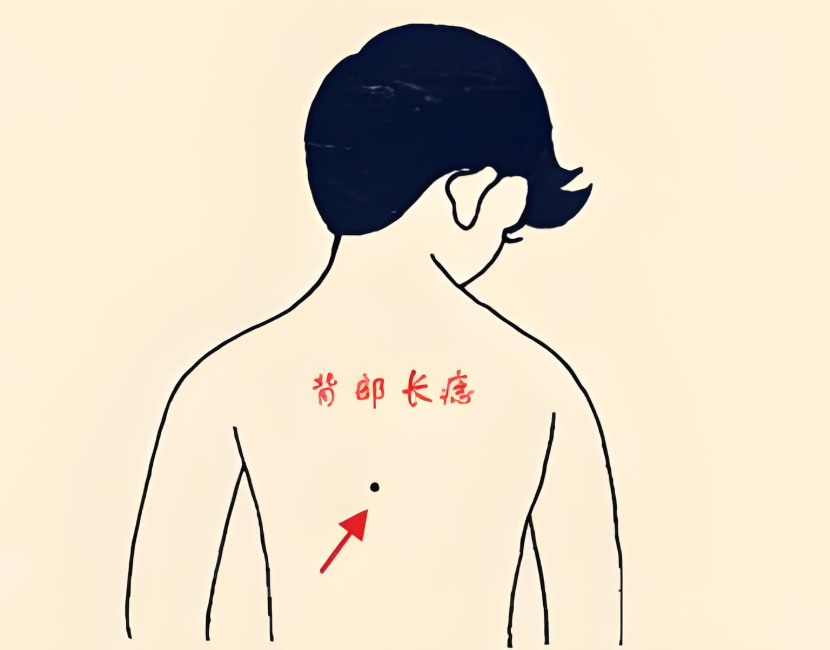 善痣和恶痣的区别图解(善痣和恶痣的区别图解大全) 善痣和恶痣的区别图解(善痣和恶痣的区别图解大全)