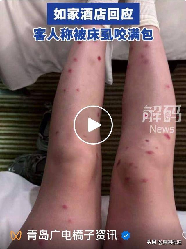 女人做梦梦见被虫子咬感觉疼(女人做梦梦见被虫子咬感觉疼解梦) 女人做梦梦见被虫子咬感觉疼(女人做梦梦见被虫子咬感觉疼解梦)